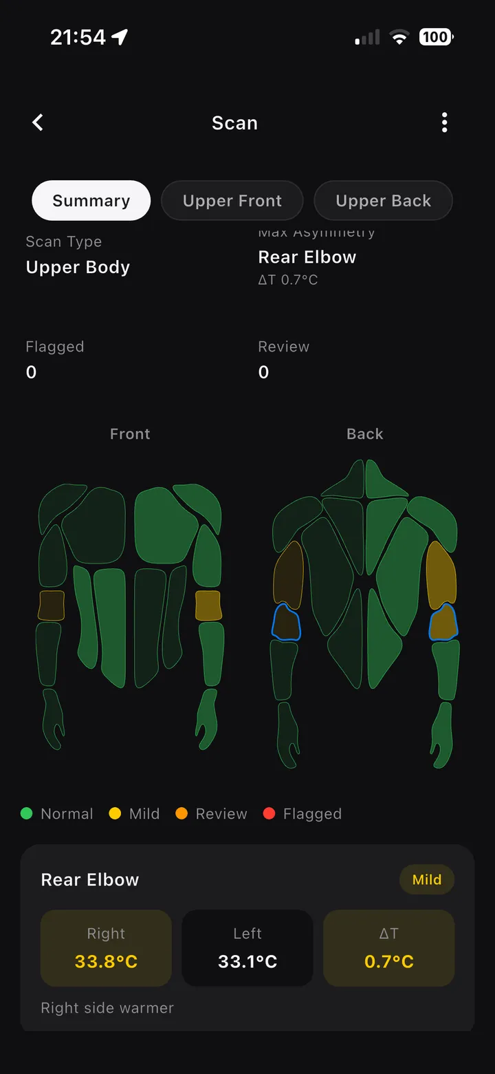 Upper-body scan summary with body map on iPhone