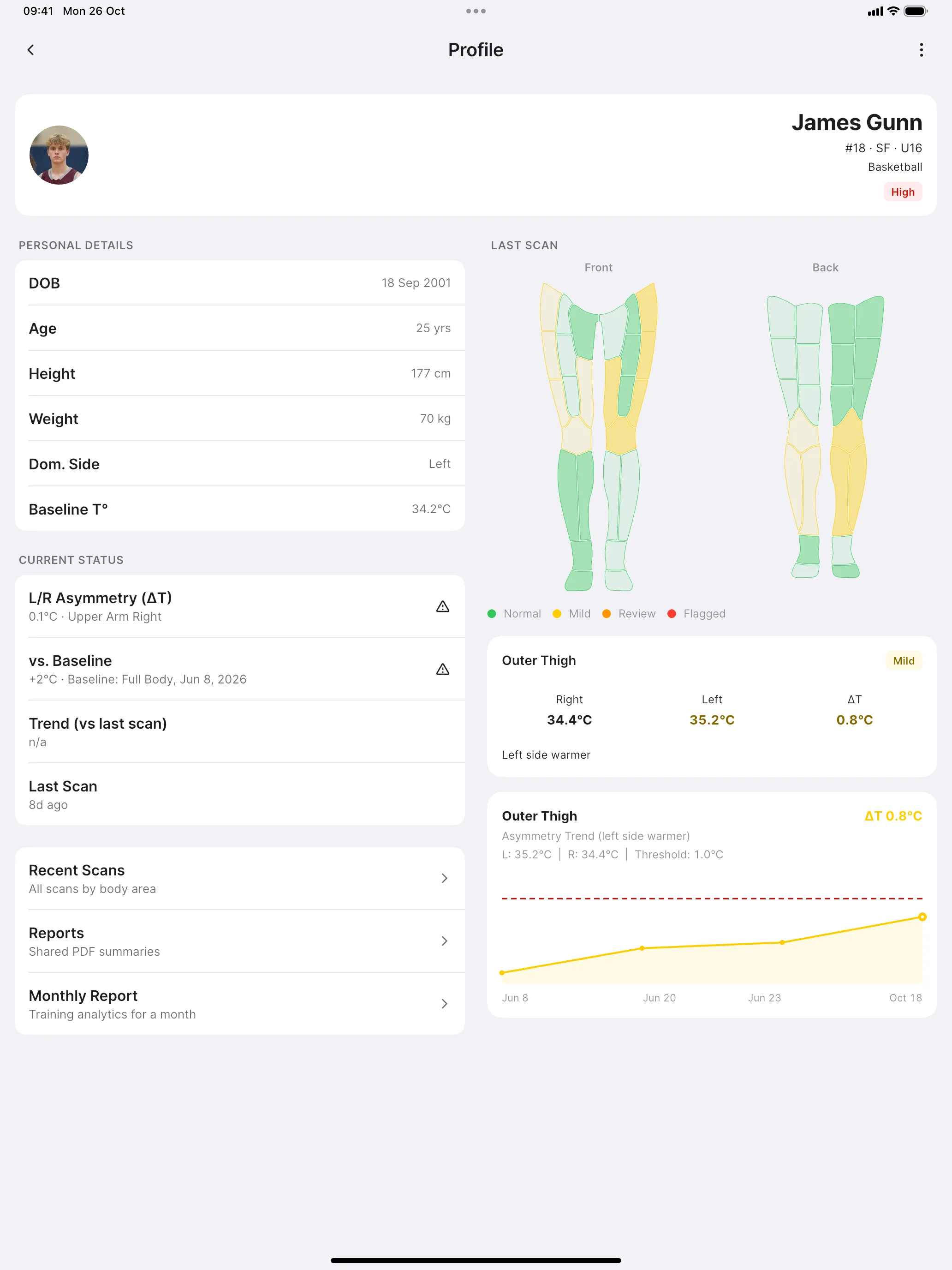 Athlete profile with the last scan's body map on a tablet